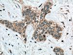 Calpain 3 Antibody in Immunohistochemistry (Paraffin) (IHC (P))