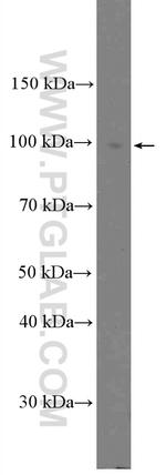Calpain 3 Antibody in Western Blot (WB)