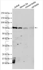 RANBP3 Antibody in Western Blot (WB)