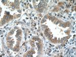 SLC25A3 Antibody in Immunohistochemistry (Paraffin) (IHC (P))