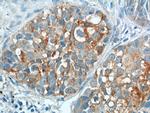 CEA Antibody in Immunohistochemistry (Paraffin) (IHC (P))