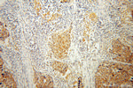 ENOX2 Antibody in Immunohistochemistry (Paraffin) (IHC (P))