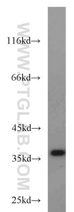 JTV1 Antibody in Western Blot (WB)