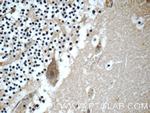 JTV1 Antibody in Immunohistochemistry (Paraffin) (IHC (P))