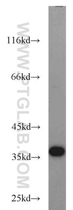 JTV1 Antibody in Western Blot (WB)