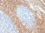 CD52 (Epididymis-Specific Protein 5) Recombinant Rabbit Monoclonal Antibody (CD52, 2276R)
