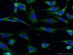 CDK5 Antibody in Immunocytochemistry (ICC/IF)
