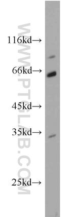 CDK5 Antibody in Western Blot (WB)