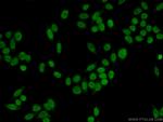 DDB2 Antibody in Immunocytochemistry (ICC/IF)