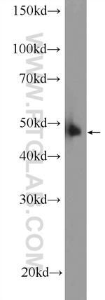 DDB2 Antibody in Western Blot (WB)
