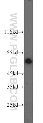 DDB2 Antibody in Western Blot (WB)