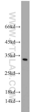 Synaptogyrin 1 Antibody in Western Blot (WB)