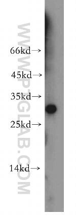 Synaptogyrin 1 Antibody in Western Blot (WB)