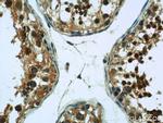 DIABLO Antibody in Immunohistochemistry (Paraffin) (IHC (P))