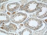 DIABLO Antibody in Immunohistochemistry (Paraffin) (IHC (P))
