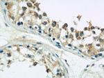 DIABLO Antibody in Immunohistochemistry (Paraffin) (IHC (P))