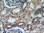 DIABLO Antibody in Immunohistochemistry (Paraffin) (IHC (P))