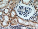 DIABLO Antibody in Immunohistochemistry (Paraffin) (IHC (P))