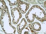 DIABLO Antibody in Immunohistochemistry (Paraffin) (IHC (P))
