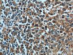 BAD Antibody in Immunohistochemistry (Paraffin) (IHC (P))