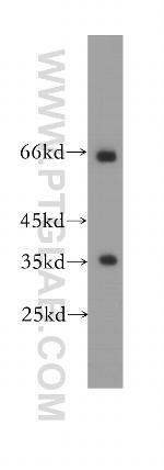 EIF3J Antibody in Western Blot (WB)