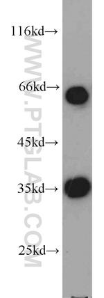 EIF3J Antibody in Western Blot (WB)