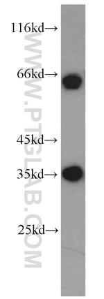 EIF3J Antibody in Western Blot (WB)