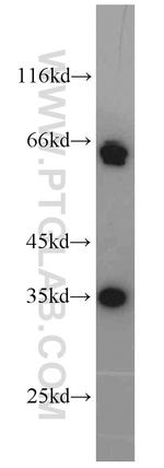 EIF3J Antibody in Western Blot (WB)