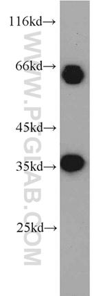 EIF3J Antibody in Western Blot (WB)