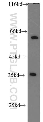 EIF3J Antibody in Western Blot (WB)