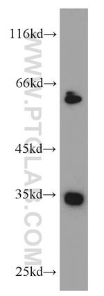 EIF3J Antibody in Western Blot (WB)