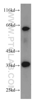 EIF3J Antibody in Western Blot (WB)