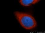 EIF3J Antibody in Immunocytochemistry (ICC/IF)