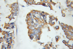 EIF3J Antibody in Immunohistochemistry (Paraffin) (IHC (P))