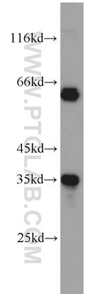 EIF3J Antibody in Western Blot (WB)