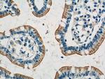 HTR3A Antibody in Immunohistochemistry (Paraffin) (IHC (P))