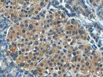 GADD34 Antibody in Immunohistochemistry (Paraffin) (IHC (P))