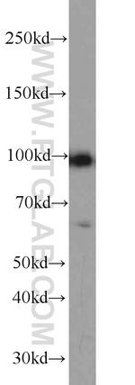 GADD34 Antibody in Western Blot (WB)