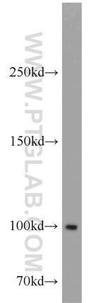GADD34 Antibody in Western Blot (WB)