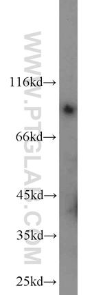 GADD34 Antibody in Western Blot (WB)
