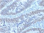 CDX2/Caudal Type Homeobox 2 (GI Epithelial Marker) Monoclonal Antibody (PCRP-CDX2-1A3)