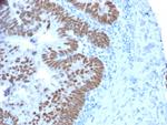 CDX2/Caudal Type Homeobox 2 (GI Epithelial Marker) Monoclonal Antibody (CDX2/2214)