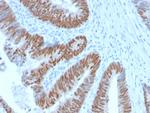 CDX2/Caudal Type Homeobox 2 Recombinant Rabbit Monoclonal Antibody (CDX2, 2951R)