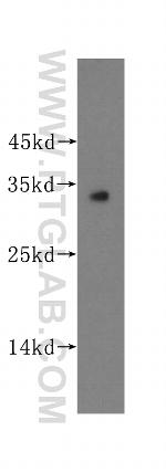 Connexin-32 Antibody in Western Blot (WB)