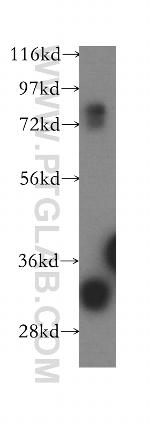 Connexin-32 Antibody in Western Blot (WB)