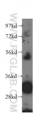 Connexin-32 Antibody in Western Blot (WB)