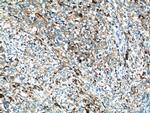 SLC45A2 Antibody in Immunohistochemistry (Paraffin) (IHC (P))