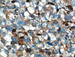 SLC45A2 Antibody in Immunohistochemistry (Paraffin) (IHC (P))