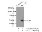 SLC45A2 Antibody in Immunoprecipitation (IP)