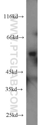 SLC45A2 Antibody in Western Blot (WB)